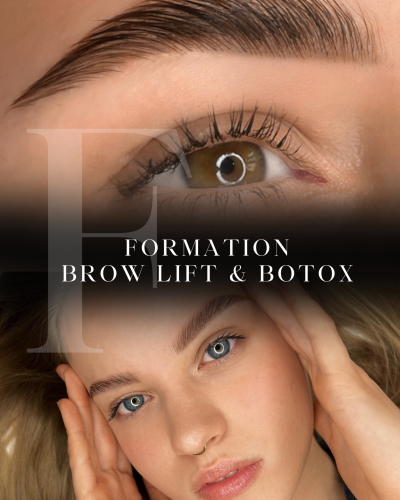 Formation Brow Lift