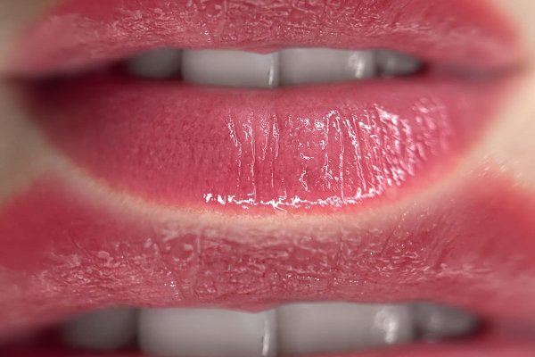 Natural lips