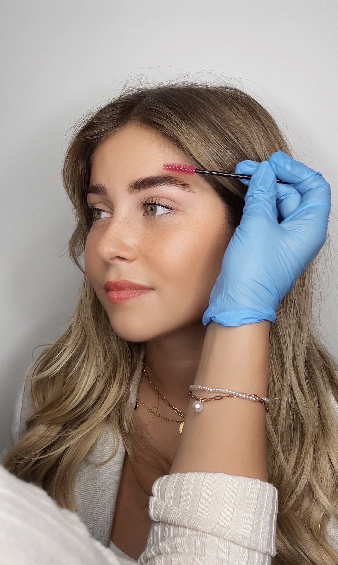 Brow lift